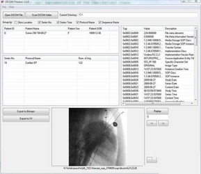 DICOM Preview 1.1.6